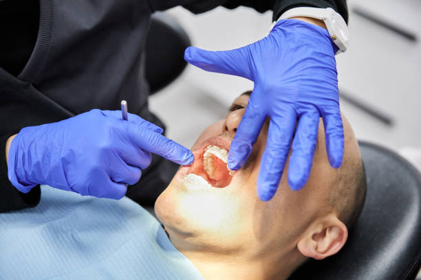 Best Urgent Care for Lost Fillings or Crowns in Western Lake, TX